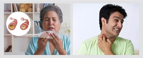 رطوبت و آلرژی